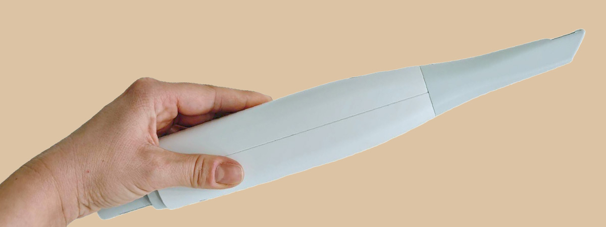 Digitaler Abdruck beim Zahnarzt